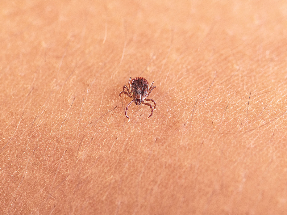 An adult female Asian longhorned tick, Haemaphysalis longicornis, crawling on a person’s skin.